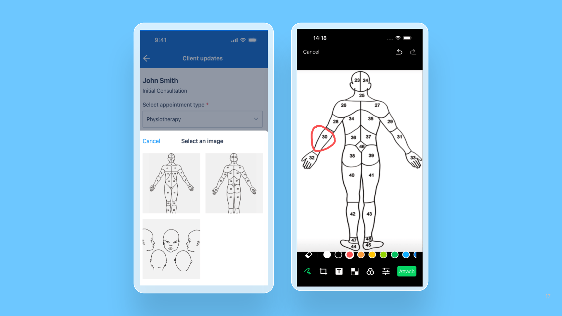 Mobile Extension (MEX) – Image annotation component release note